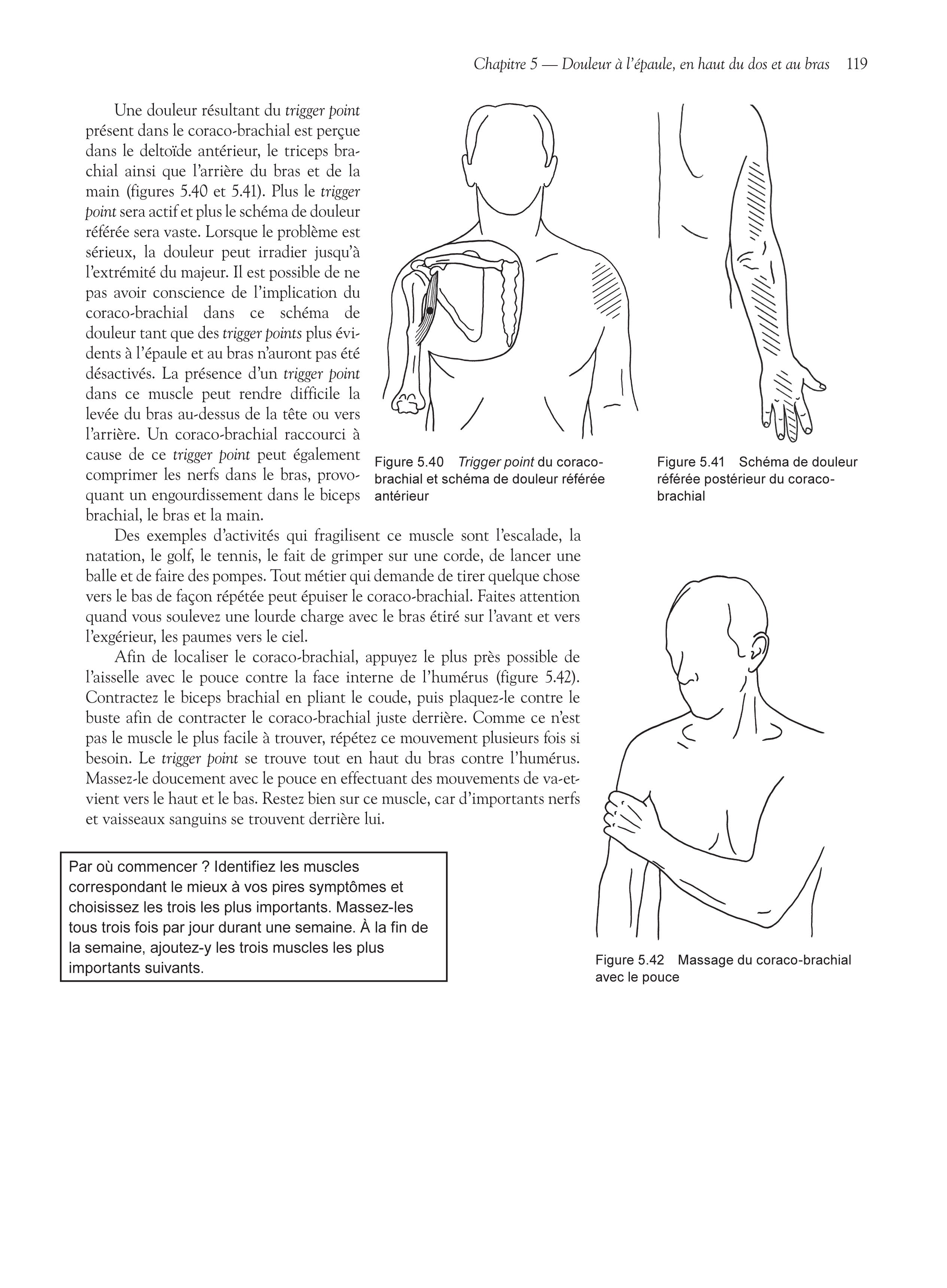 Souccar Soulagez vos douleurs par les trigger points livre broché